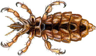 Des astuces pour se débarrasser des poux. Des astuces pour se débarrasser des poux.