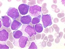 Je donne ma Moelle Osseuse. Je donne ma Moelle Osseuse.